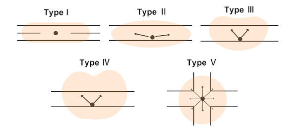 A diagram of light distribution types across five separate roadways. 
